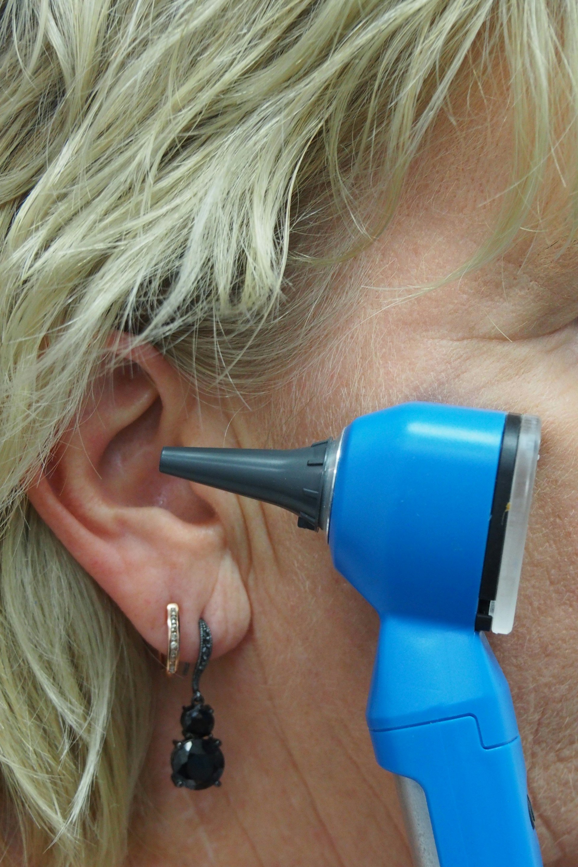Earwax removal at Cornwell's Chemists