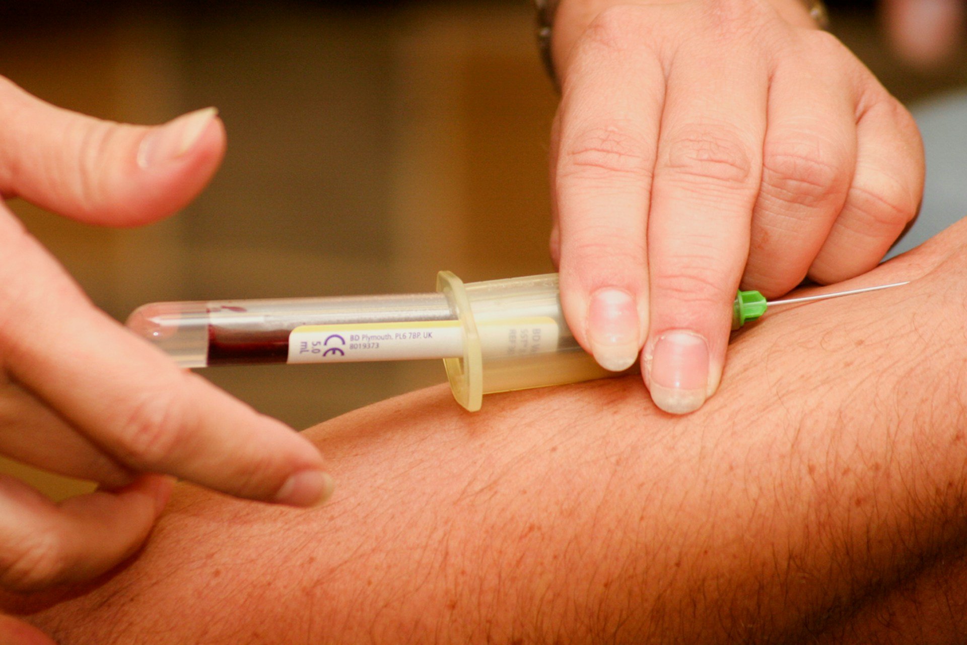 PSA testing at Cornwell's Chemists